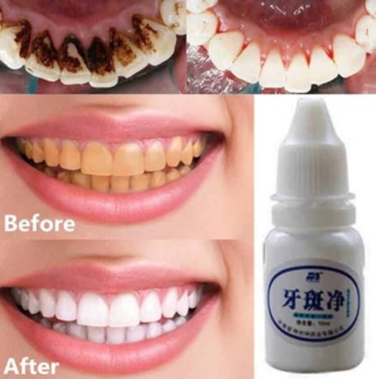 ya ban pemutih gigi teeth whitening essence cleaning serum 10ml a546 2