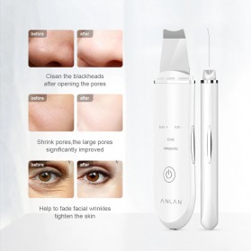 ANLAN C-105 Pembersih Wajah Elektrik Ultrasonic Facial Skin Scrubber Ion Acne Skin Cleanser - ALDRY03-02 - White - 3