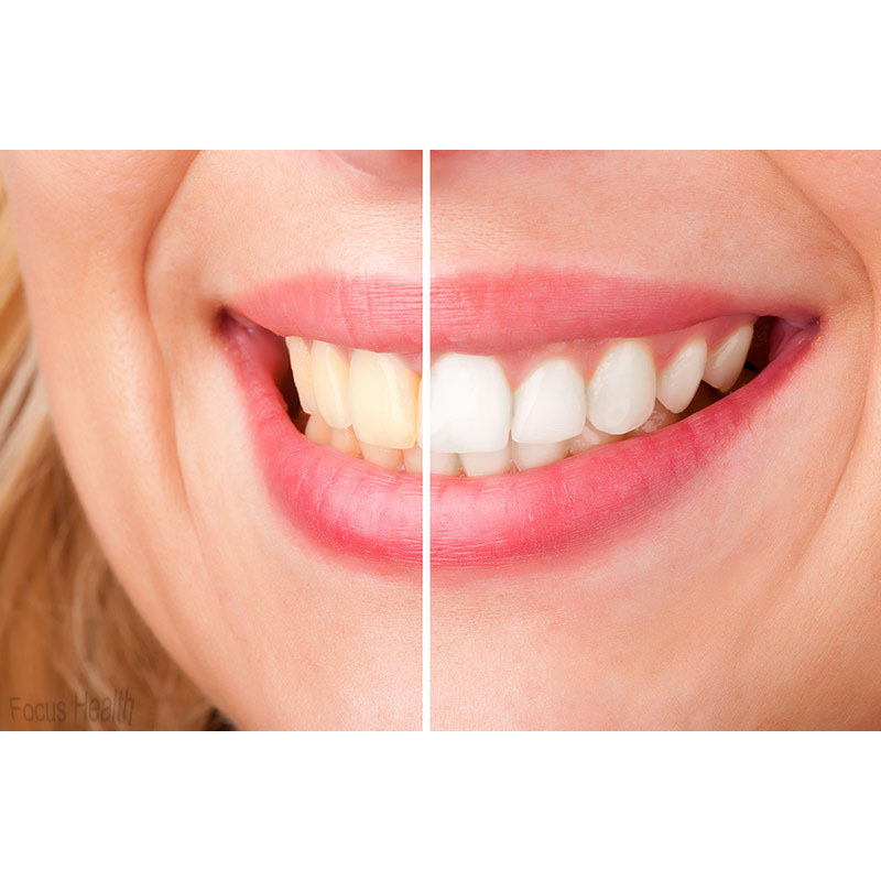 pemutih gigi ultra whitening 3d teeth strips 14pcs pemutih gigi ultra whitening 3d teeth strips 14pcs