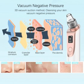 ANLAN Penghisap Komedo Vacuum Suction Skin Face Care Blackhead Pore Cleaner - ALHTY03-01R - White - 5