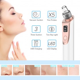 ANLAN Penghisap Komedo Vacuum Suction Skin Face Care Blackhead Pore Cleaner - ALHTY03-01R - White - 10