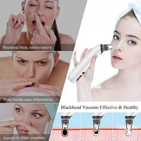 ANLAN HTY08 Penghisap Komedo Vacuum Suction Skin Face Care Blackhead Pore Cleaner - ALHTY08-02 - White - 11